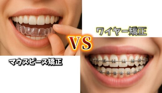 マウスピース矯正とワイヤー矯正、どっちがいい？実体験とメリット・デメリット比較