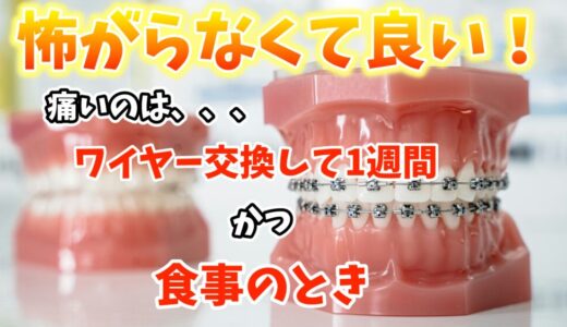 【矯正って痛い？】痛みの原因・期間・乗り越え方を経験者が解説！